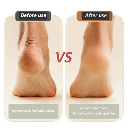 ⏰Big Sale 50% OFF🔥2025 NEW USB Rechargeable Foot Repair and Grinding Device