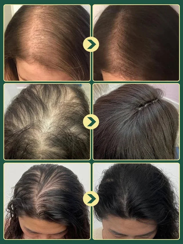 Limited Time🌿Unlock Better Hair with 70% OFF🔥Herbal Essence Nourishing Repair Shampoo ⚡⚡  [The less hair, the better the effect]