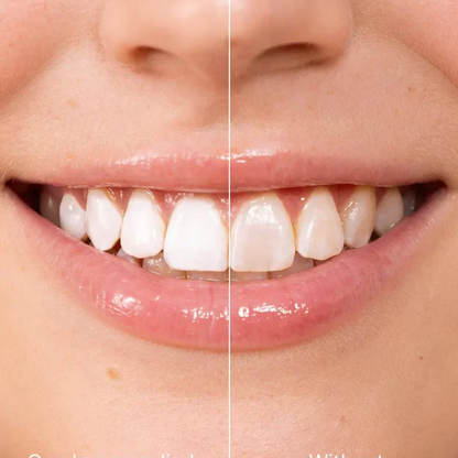 📢📢 BUY 1 GET 1 FREE!!⚡50K+ SOLD!💝Instant Whitening Tooth Paint